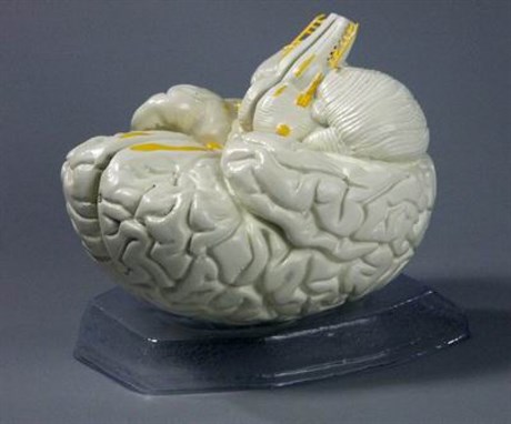 Модель "Мозг в разрезе" - фото 150308